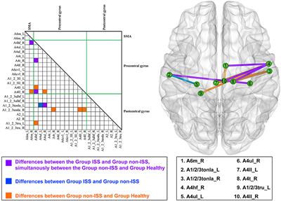 Characteristic Alterations of Network in Patients With Intraoperative Stimulation-Induced Seizures During Awake Craniotomy